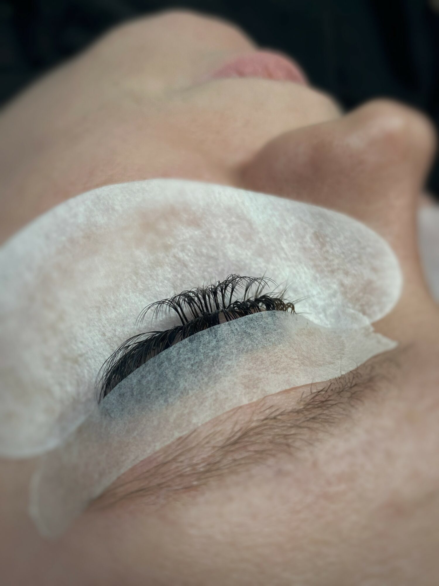 Close-up of a person's eye with eyelash extensions, partially covered by a white patch, with skin visible around.