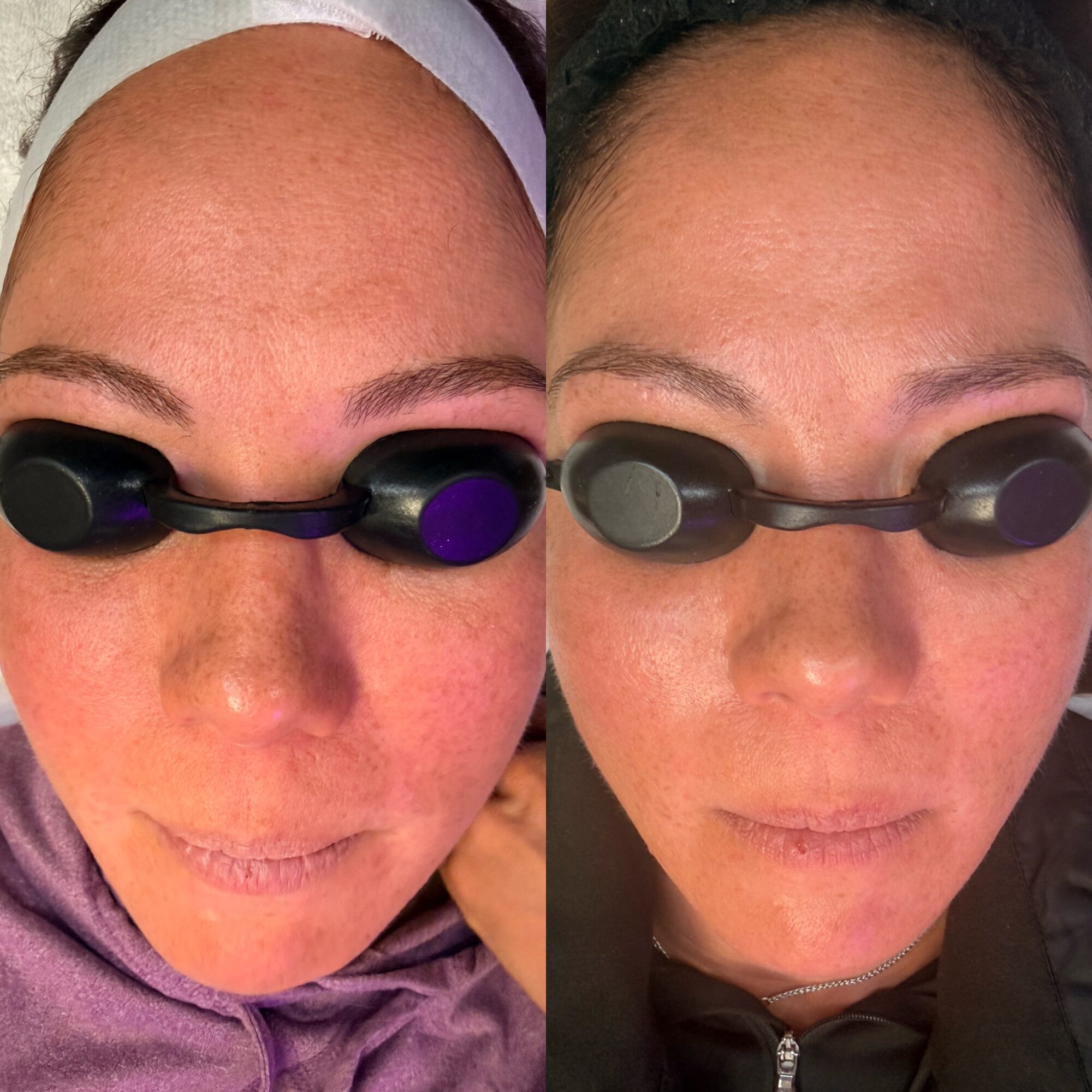 Side-by-side comparison of a woman's face before and after skincare, showing improved skin texture and tone.